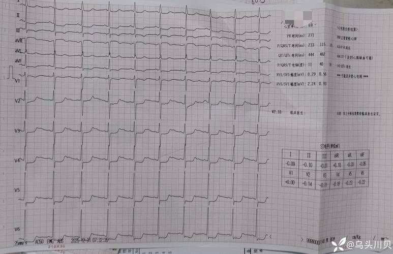 三原县6月25日死亡病例曲线图表_三原县确诊一例
